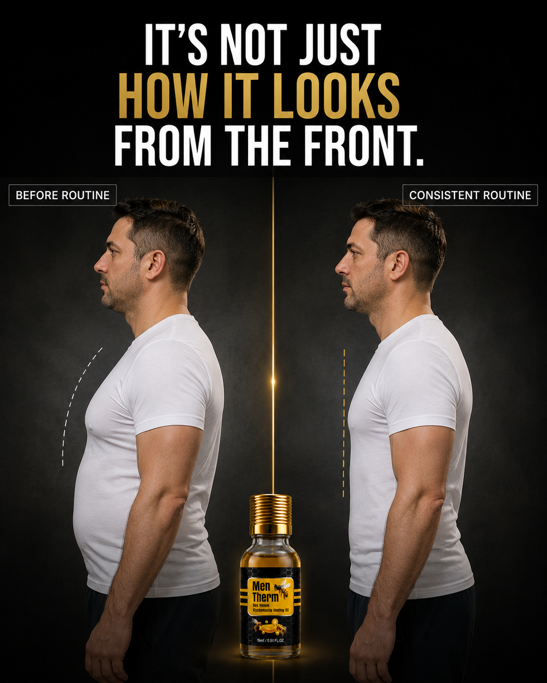 Men Therm - Bee Venom Gynecomastia Heating Oil