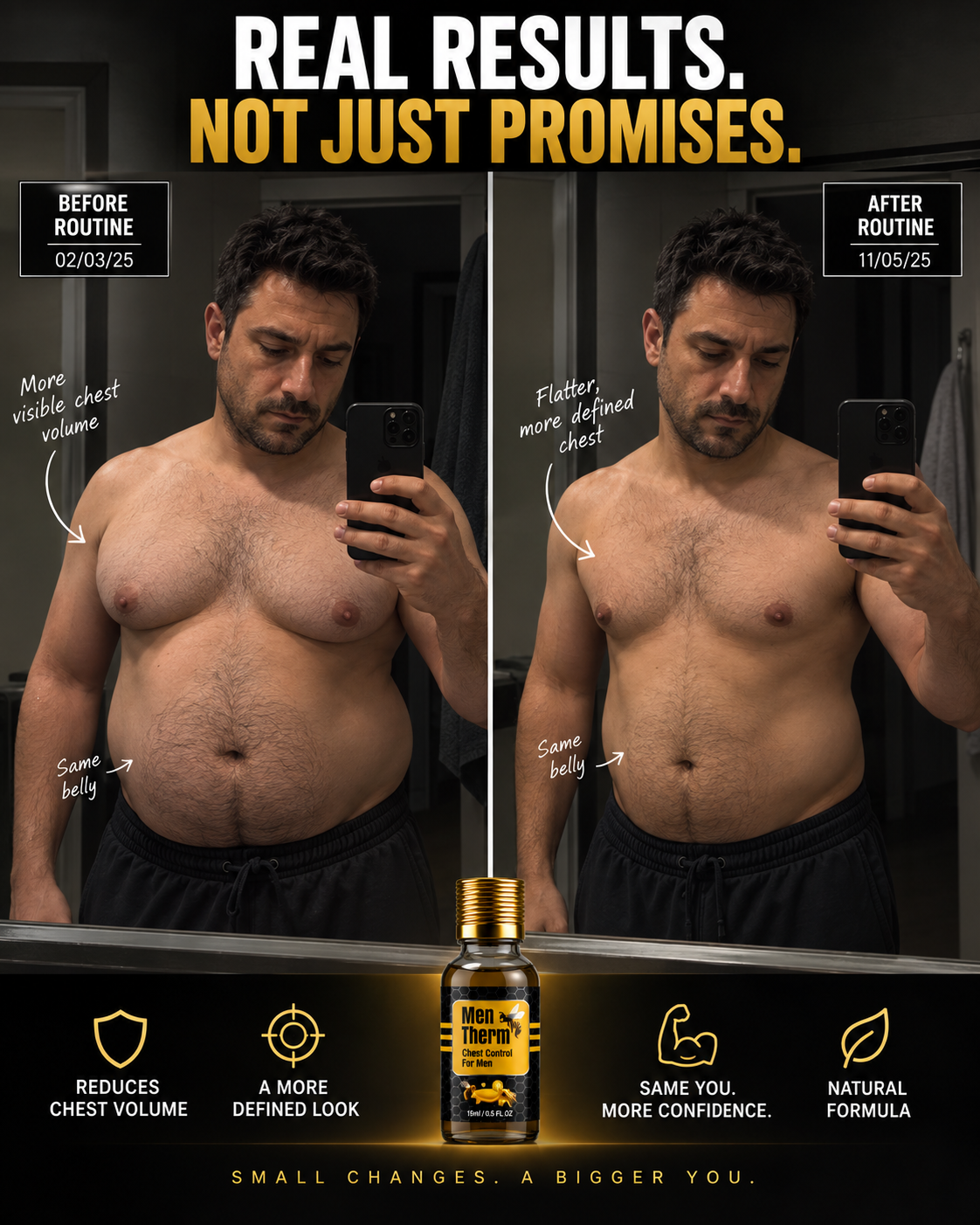 Men Therm - Bee Venom Gynecomastia Heating Oil